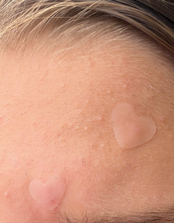 Magic CLEAR heart pimple patches - jumbo pack